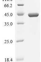 Escherichia coli Phenylalanine--tRNA ligase alpha subunit (pheS) Recombinant Protein - BioCrest Sci