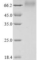 Human Antithrombin-III (SERPINC1)(R294H) Recombinant Protein - BioCrest Sci