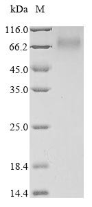 Human Antithrombin-III (SERPINC1)(R294H) Recombinant Protein, Homo sapiens (Human), Mammalian cell, N-terminal 6xHis-tagged, 54.7 kDa, purity >≥ 85% as determined by SDS-PAGE.