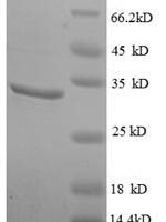 Human Chromodomain-helicase-DNA-binding protein 4 (CHD4), partial Recombinant Protein - BioCrest Sci