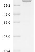 Yellow fever virus Genome polyprotein, partial, Biotinylated Recombinant Protein - BioCrest Sci