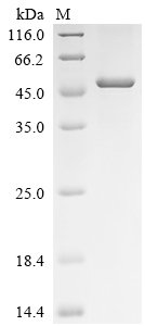 Xenopus laevis Decapping and exoribonuclease protein (dxo) Recombinant Protein, N-His, Xenopus laevis (African clawed frog), E.coli, N-terminal 6xHis-tagged, 50.3 kDa, purity >≥ 85% as determined by SDS-PAGE.