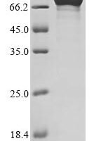 Human 2-5A-dependent ribonuclease (RNASEL) Recombinant Protein, C-Myc - BioCrest Sci