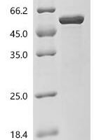 Human Filamin-B (FLNB), partial Recombinant Protein - BioCrest Sci