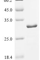 Mouse Tolloid-like protein 1 (Tll1), partial Recombinant Protein - BioCrest Sci