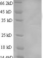 Human C-X-C motif chemokine 13 protein (CXCL13), partial Recombinant Protein - BioCrest Sci