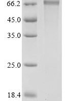 Human Pyruvate dehydrogenase E1 component subunit alpha, somatic form, mitochondrial (PDHA1), partial Recombinant Protein, N-GST - BioCrest Sci