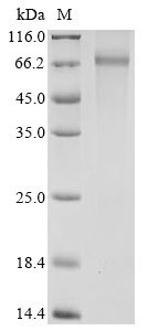 Human Pyruvate dehydrogenase E1 component subunit alpha, somatic form, mitochondrial (PDHA1), partial Recombinant Protein, N-GST, Homo sapiens (Human), E.coli, N-terminal GST-tagged, 67.6 kDa, purity >≥ 85% as determined by SDS-PAGE.