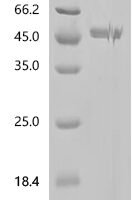 Pig Complement C3 (C3), partial Recombinant Protein, N-His-SUMOstar - BioCrest Sci