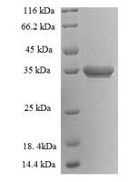 Human Lysine-specific demethylase 5A (KDM5A) Recombinant Protein - BioCrest Sci