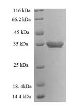 Human Lysine-specific demethylase 5A (KDM5A) Recombinant Protein, Homo sapiens (Human), E.coli, N-terminal 6xHis-SUMO-tagged, 35.3 kDa, purity >≥ 90% as determined by SDS-PAGE.
