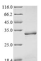 Human Peroxisomal biogenesis factor 3 (PEX3), partial Recombinant Protein - BioCrest Sci