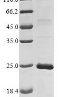Human Cancer/testis antigen 1 (CTAG1A) Recombinant Protein, N-10His - BioCrest Sci