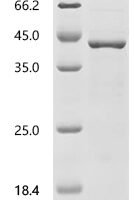 Human Cyclin-dependent kinase 12 (CDK12), partial Recombinant Protein, C-His - BioCrest Sci