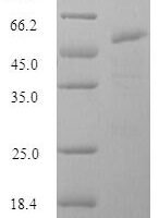 Influenza A virus Hemagglutinin (HA), partial Recombinant Protein, N-His-SUMO, aa 16–339, strain A/Mallard/New York/6750/1978 H2N2 - BioCrest Sci