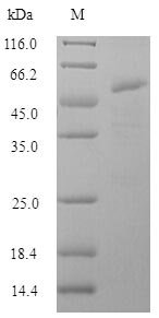 Influenza A virus Hemagglutinin (HA), partial Recombinant Protein, N-His-SUMO, aa 16–339, strain A/Mallard/New York/6750/1978 H2N2, Influenza A virus (strain A/Mallard/New York/6750/1978 H2N2), E.coli, N-terminal 6xHis-SUMO-tagged, 52.2 kDa, purity >≥ 90% as determined by SDS-PAGE.