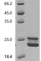 Aspergillus niger Probable endo-1,4-beta-xylanase B (xlnB) Recombinant Protein, C-His - BioCrest Sci