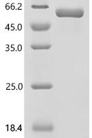 Mouse Microtubule-associated protein 4 (Map4), partial Recombinant Protein - BioCrest Sci