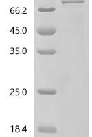 Human Transient receptor potential cation channel subfamily V member 4 (TRPV4), partial Recombinant Protein - BioCrest Sci