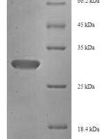 Human Fibroblast growth factor 13 (FGF13) Recombinant Protein - BioCrest Sci