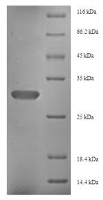 Human Fibroblast growth factor 13 (FGF13) Recombinant Protein, Homo sapiens (Human), E.coli, N-terminal 6xHis-tagged, 31.6 kDa, purity >≥ 90% as determined by SDS-PAGE.
