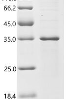Mouse DNA mismatch repair protein Msh3 (Msh3), partial Recombinant Protein - BioCrest Sci