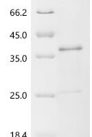 Epstein-Barr virus Epstein-Barr nuclear antigen 2 (EBNA2), partial Recombinant Protein, C-His, aa 320–487, E.coli - BioCrest Sci