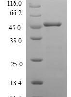 Human Neurocalcin-delta (NCALD) Recombinant Protein - BioCrest Sci