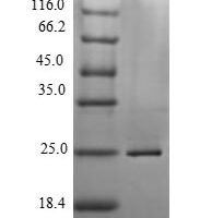 Micrurus tener tener Kunitz-type neurotoxin MitTx-alpha Recombinant Protein, N-His - BioCrest Sci