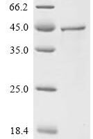 Human Norrin (NDP) Recombinant Protein, C-GST - BioCrest Sci