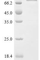 Escherichia coli Glycine--tRNA ligase beta subunit (glyS) Recombinant Protein - BioCrest Sci