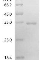 Human T-cell surface antigen CD2 (CD2), partial Recombinant Protein, C-His - BioCrest Sci