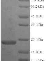 Bauhinia ungulata Factor Xa inhibitor BuXI (BuXI) Recombinant Protein, N-His, aa 1–172, E.coli - BioCrest Sci