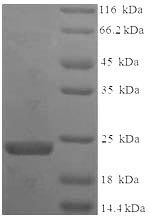 Bauhinia ungulata Factor Xa inhibitor BuXI (BuXI) Recombinant Protein, N-His, aa 1–172, E.coli, Bauhinia ungulata (Orchid tree), E.coli, N-terminal 6xHis-tagged, 23.2 kDa, purity >≥ 90% as determined by SDS-PAGE.