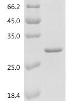 Mouse Tumor necrosis factor ligand superfamily member 12 (Tnfsf12), partial Recombinant Protein, C-His - BioCrest Sci