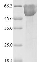 Human Mucosal addressin cell adhesion molecule 1 (MADCAM1), partial Recombinant Protein, N-10His - BioCrest Sci