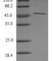 Human Ras-related C3 botulinum toxin substrate 3 (RAC3) Recombinant Protein - BioCrest Sci
