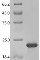 Saccharomyces cerevisiae 12 kDa heat shock protein (HSP12) Recombinant Protein - BioCrest Sci