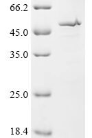 Human Cytochrome P450 2A6 (CYP2A6), partial Recombinant Protein - BioCrest Sci