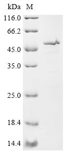 Human Cytochrome P450 2A6 (CYP2A6), partial Recombinant Protein, Homo sapiens (Human), E.coli, Tag-Free, 53.5 kDa, purity >≥ 85% as determined by SDS-PAGE.
