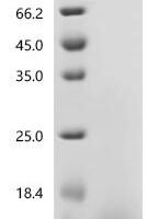 Mouse Guanylate cyclase activator 2B (Guca2b) Recombinant Protein, Tag-Free - BioCrest Sci