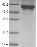 Human T-complex protein 1 subunit zeta (CCT6A) Recombinant Protein - BioCrest Sci