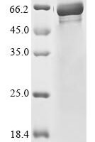 Mouse Nicotinamide phosphoribosyltransferase (Nampt) Recombinant Protein, N-His/C-Myc - BioCrest Sci