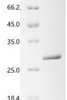 Tobacco mosaic virus Capsid protein (CP) Recombinant Protein, C-His, aa 2–159, E.coli - BioCrest Sci