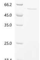 Human Casein kinase II subunit beta (CSNK2B) Recombinant Protein - BioCrest Sci