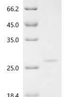 Klebsiella pneumoniae Microcin E492 (mceA) Recombinant Protein - BioCrest Sci