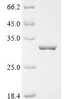 Newcastle disease virus RNA-directed RNA polymerase L (L), partial Recombinant Protein, C-His - BioCrest Sci