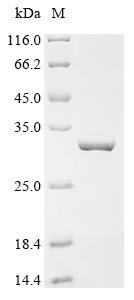 Newcastle disease virus RNA-directed RNA polymerase L (L), partial Recombinant Protein, C-His, Newcastle disease virus (strain Chicken/United States/B1/48) (NDV), E.coli, C-terminal 6xHis-tagged, 31.6 kDa, purity >≥ 95% as determined by SDS-PAGE.