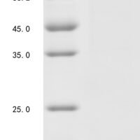 Mouse Estrogen receptor (Esr1),Biotinylated Recombinant Protein - BioCrest Sci