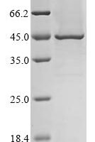 Human Transmembrane protease serine 11A (TMPRSS11A), partial Recombinant Protein, C-His - BioCrest Sci